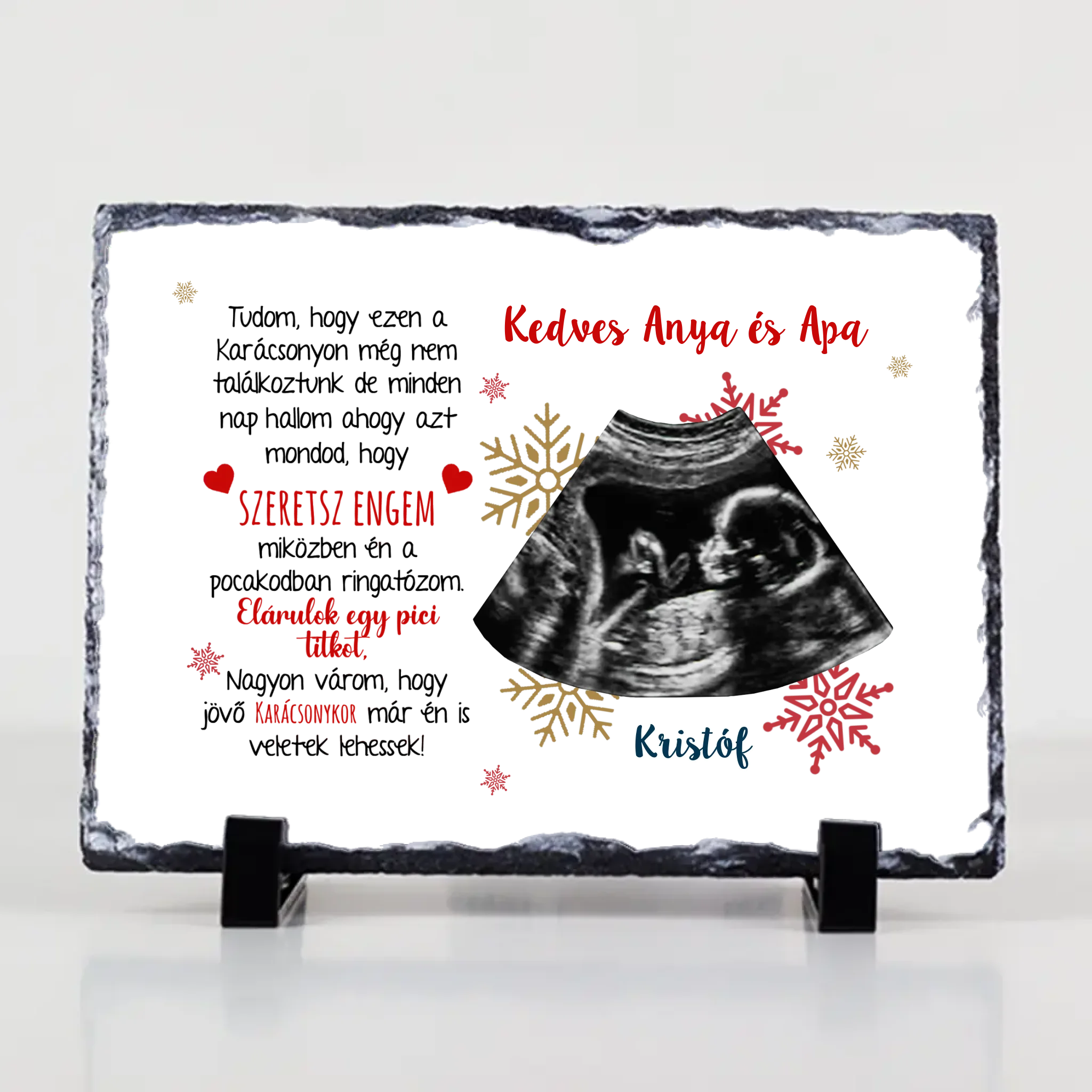 Ajándék karácsonyi gránitlap ultrahang fotóval és szerkeszthető felirattal