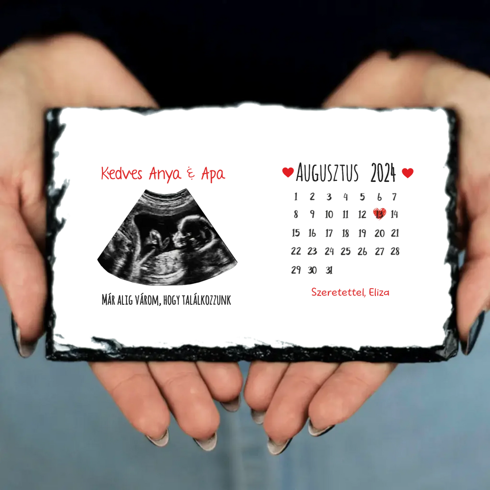 Egyedi ultrahang képes gránitlap naptárral, Várandós Anyukáknak