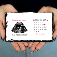 Egyedi ultrahang képes gránitlap naptárral, Várandós Anyukáknak