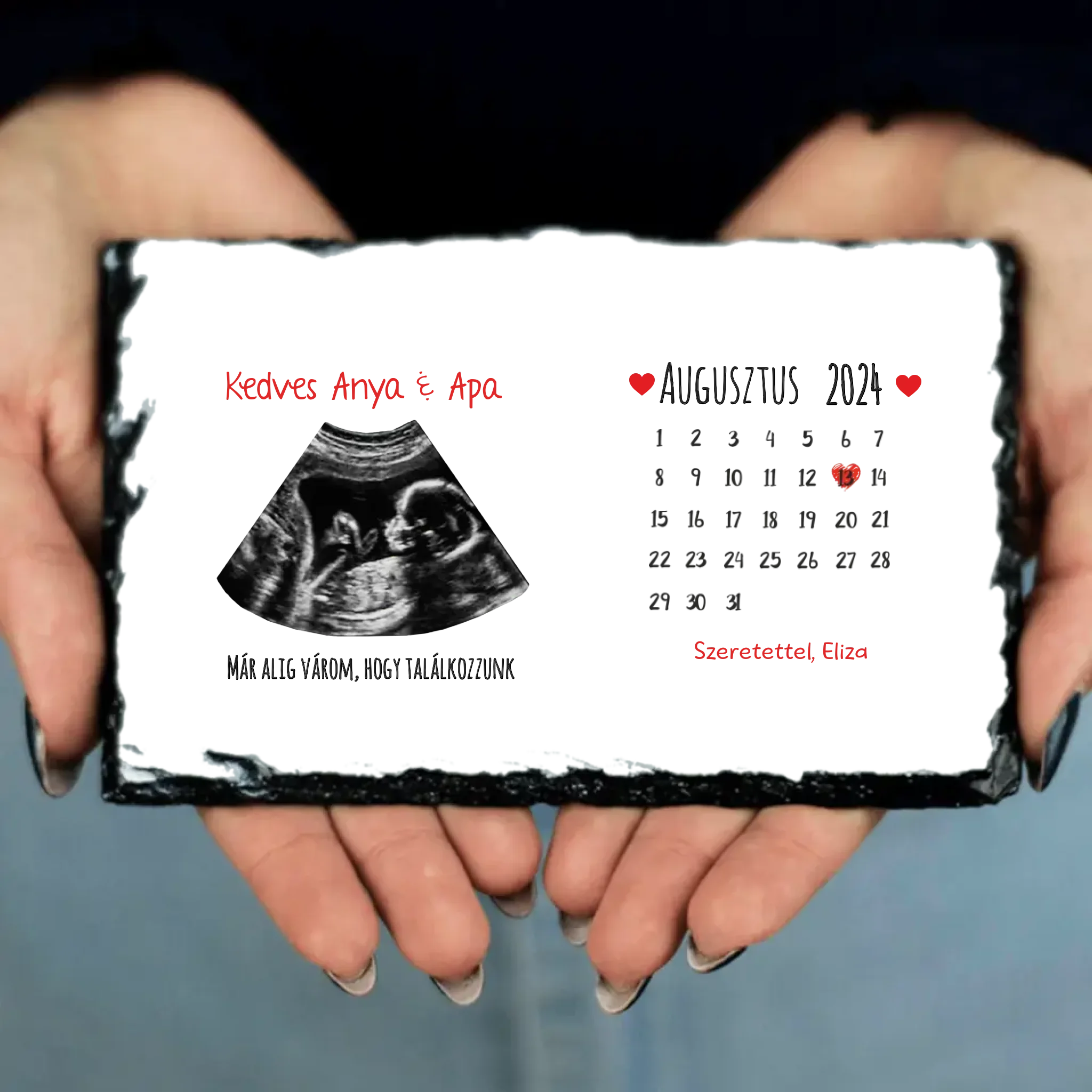Egyedi ultrahang képes gránitlap naptárral, Várandós Anyukáknak