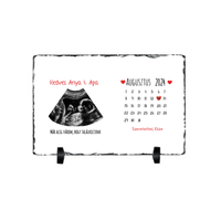 Egyedi ultrahang képes gránitlap naptárral, Várandós Anyukáknak