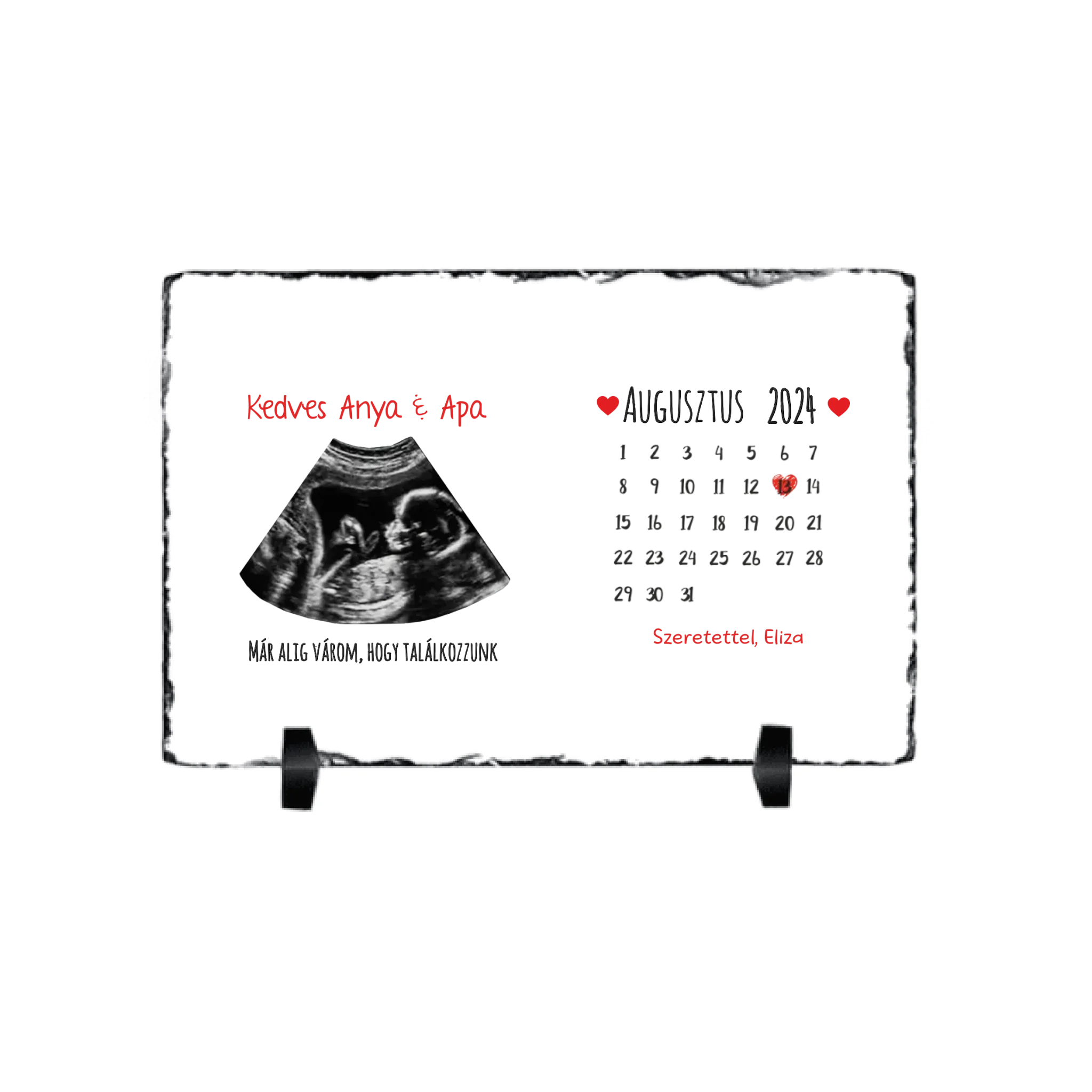 Egyedi ultrahang képes gránitlap naptárral, Várandós Anyukáknak