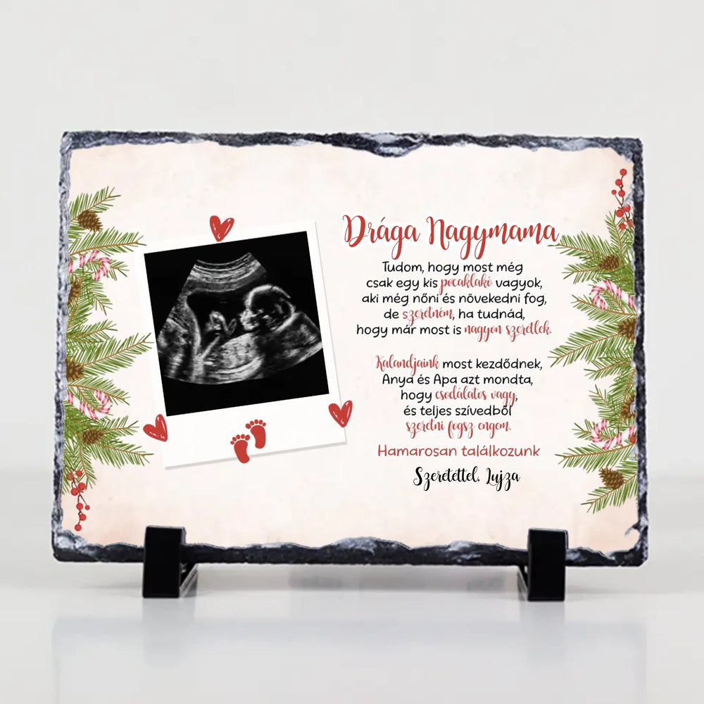 Ultrahang fotós ajándék gránitlap szerkeszthető felirattal