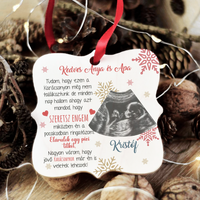 Ajándék négyzetes karácsonyfadísz ultrahang fotóval és szerkeszthető felirattal