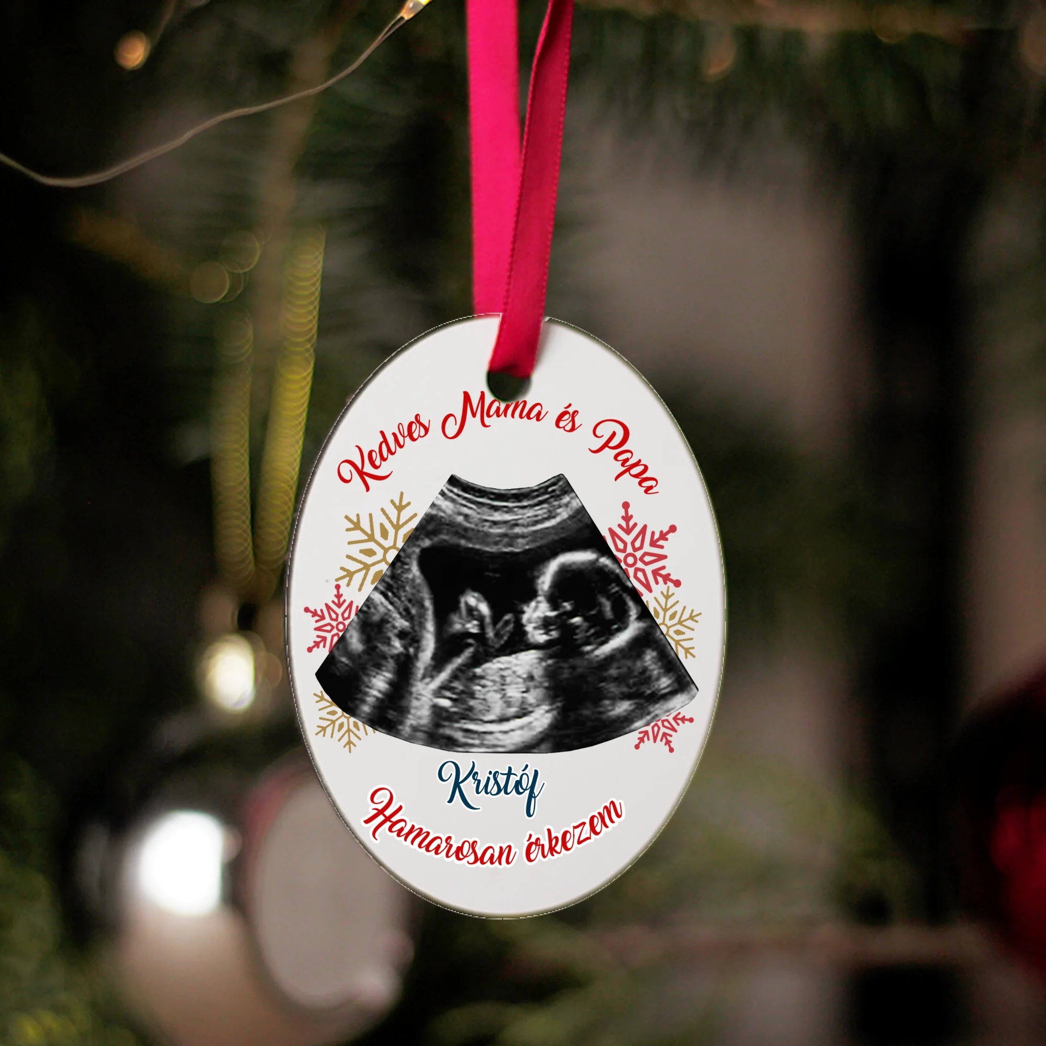 Egyedi feliratos ovális karácsonyfadísz ultrahang fotóval