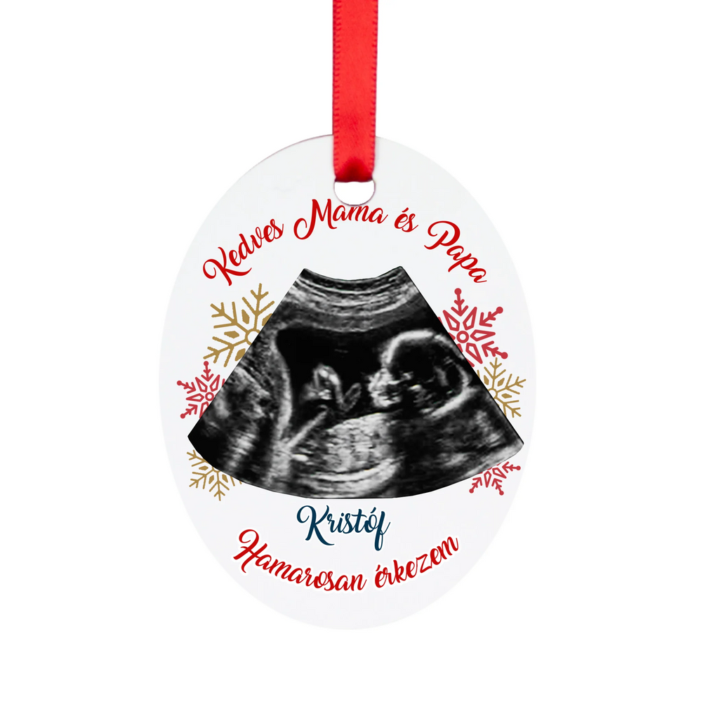 Egyedi feliratos ovális karácsonyfadísz ultrahang fotóval