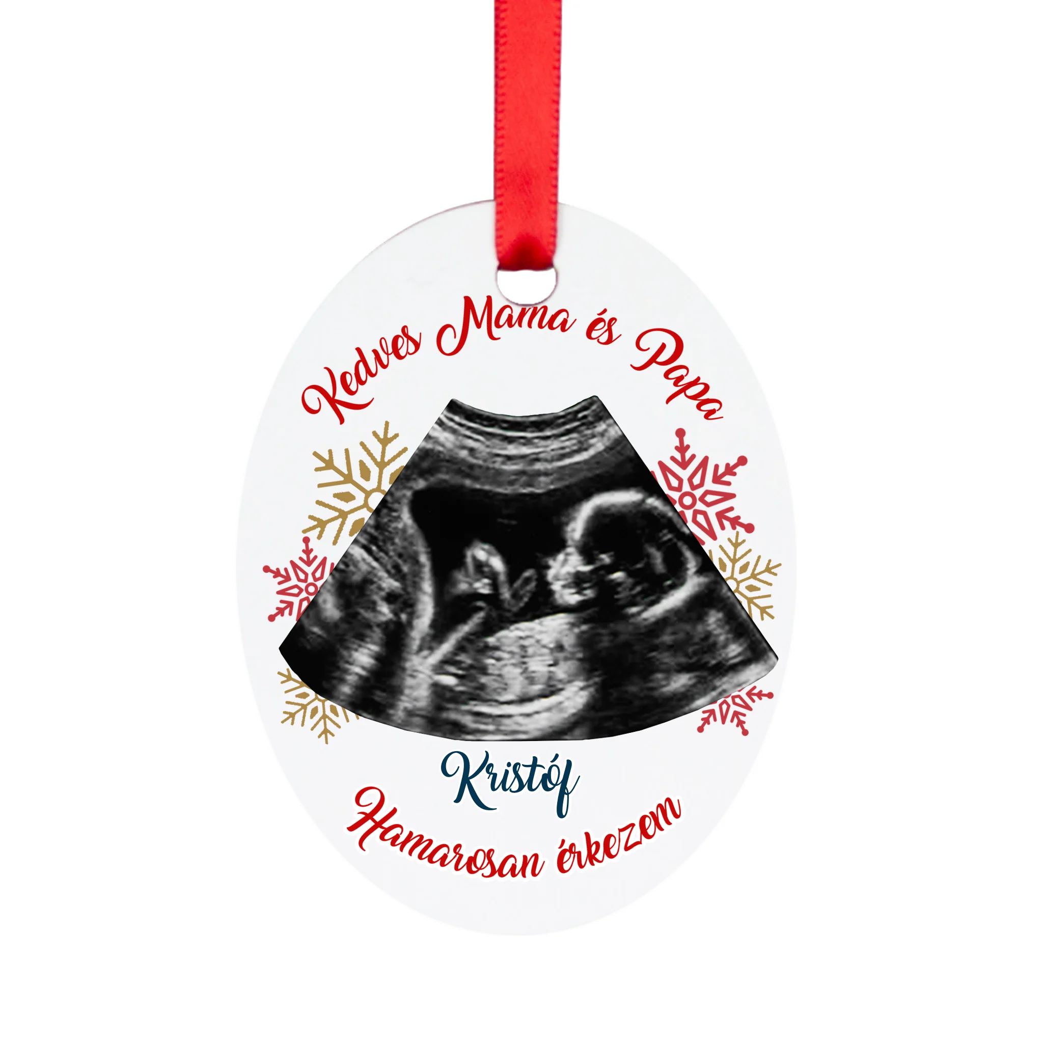 Egyedi feliratos ovális karácsonyfadísz ultrahang fotóval